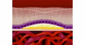Monitoring Dry AMD - Image 3 (1782)