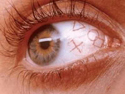 Eyeball Tattooing: To Legalise or Ban? - mivision