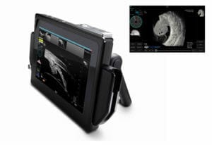 Sonomed VuPad: Innovative See And Touch Ultrasound - Mivision