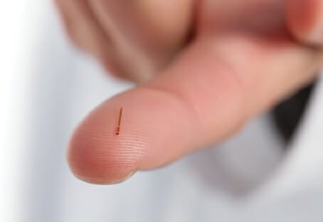 Minimally Invasive Glaucoma Surgery - Image 7 (6843)