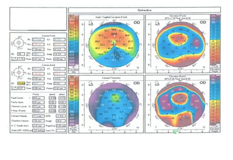 θcomplex3 eYecandy vs. θcomplex mqdefault.jpg