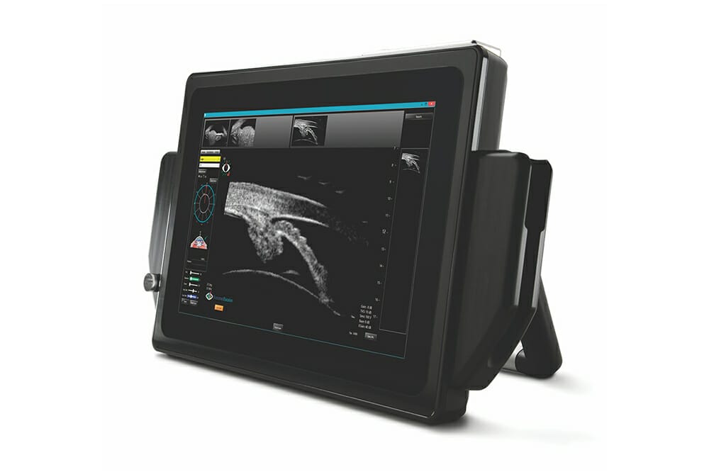 Sonomed VuPad Ultrasound - Mivision