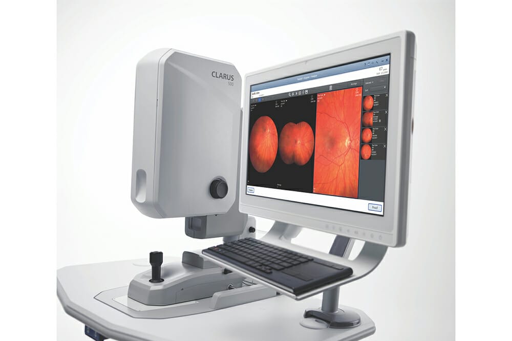 Sonomed VuPad Ultrasound - Mivision