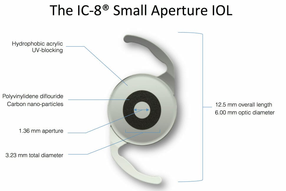 Maximising Presbyopia Correction With Extended Depth Of Focus IOLs Mivision