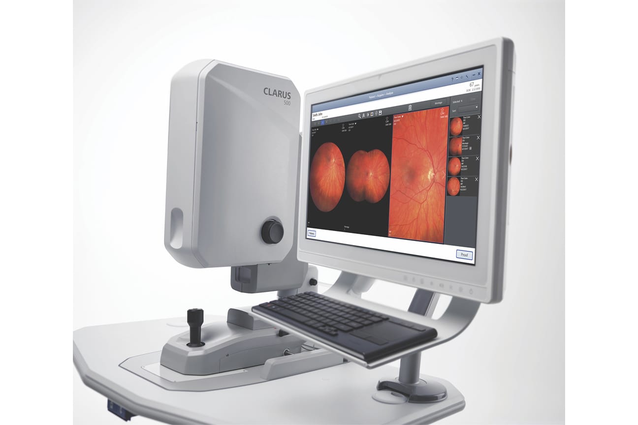 Zeiss Clarus 700 Retinal Imaging mivision Zeiss Clarus 700 Retinal Imaging mivision