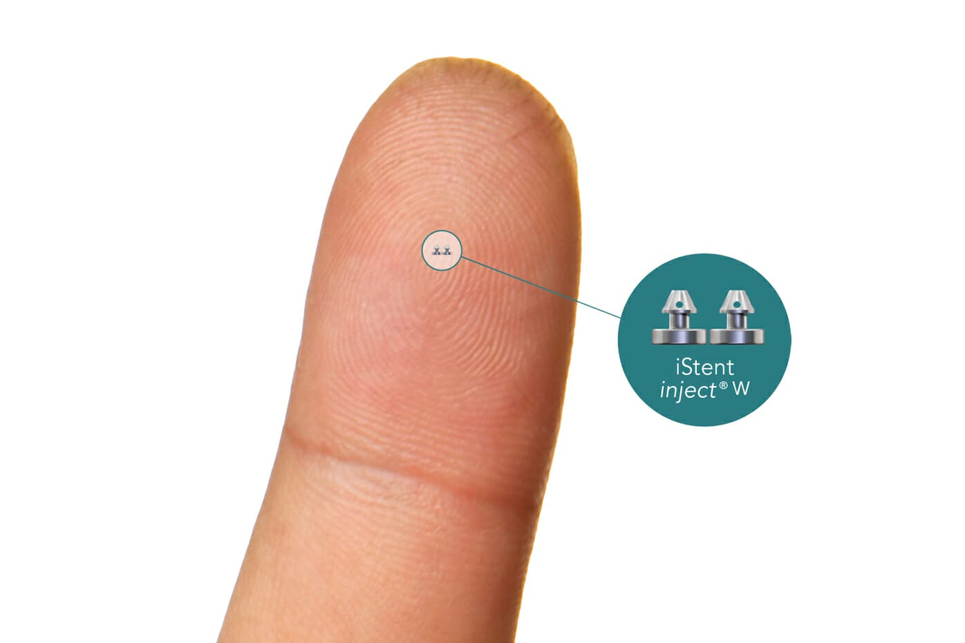 Evolved: iStent inject W - mivision