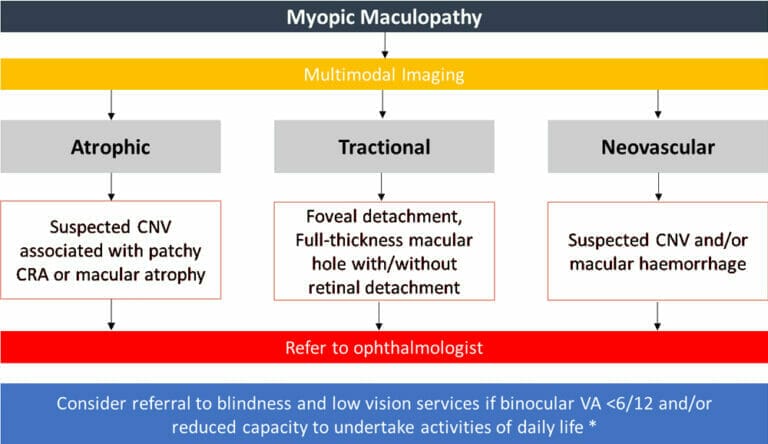 Myopic Maculopathy: A Practical Guide - Mivision