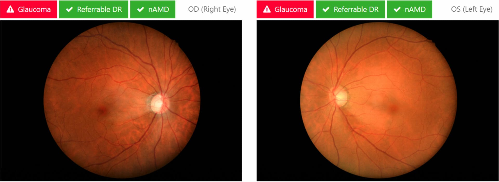 Artificial Intelligence in Eye Care: The Future is Now - mivision