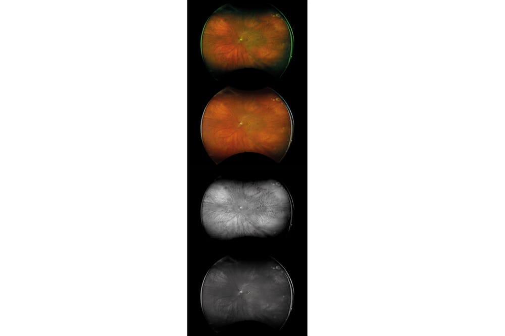 Optos: Now with More Image Modalities - mivision