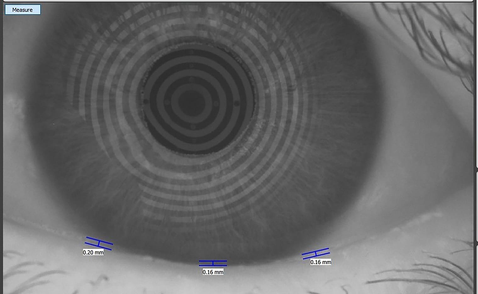 Ocular imaging.