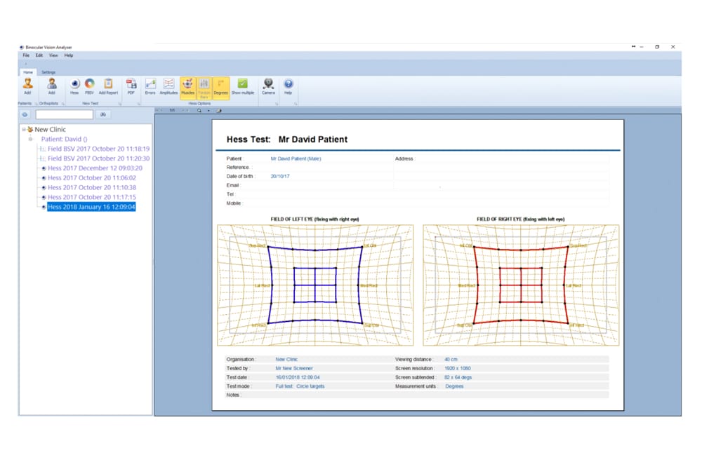 Output from binocular vision analyzer