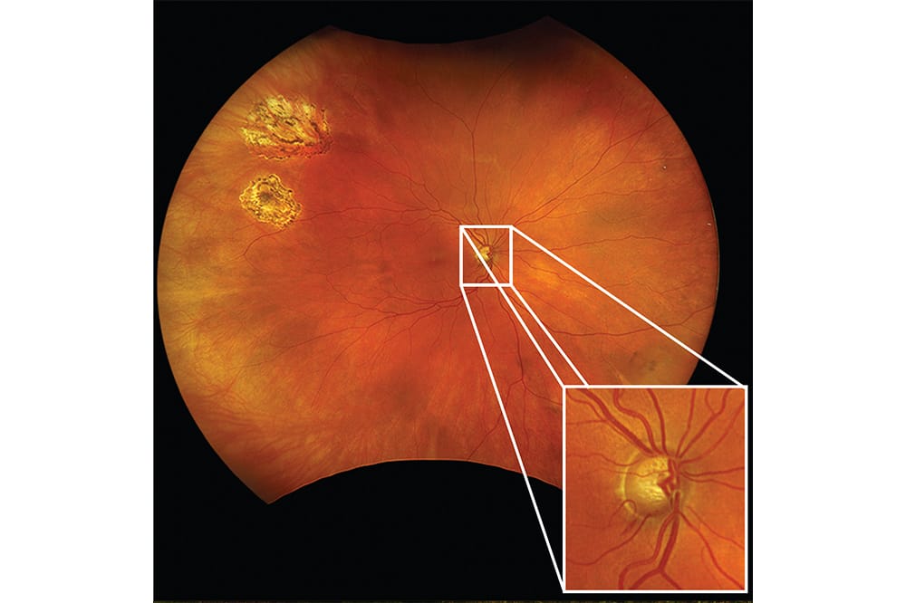 Optomap imaging
