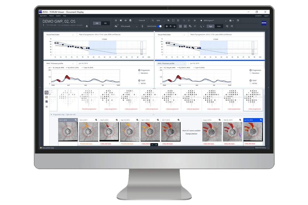 ZEISS Glaucoma Workplace