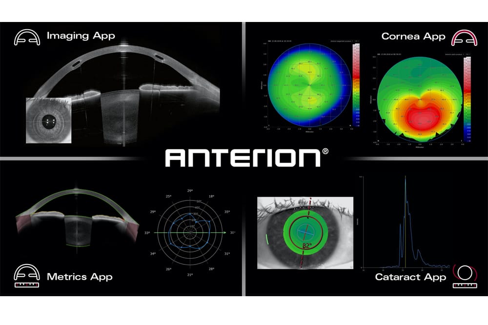 Screenshot from Anterion Cataract App