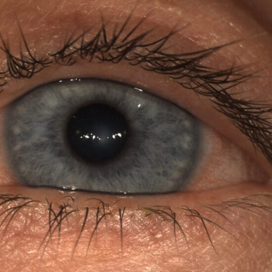closeup of eye