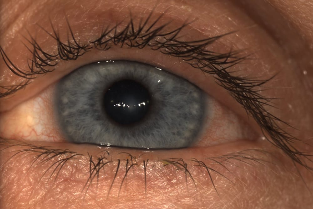 closeup of eye