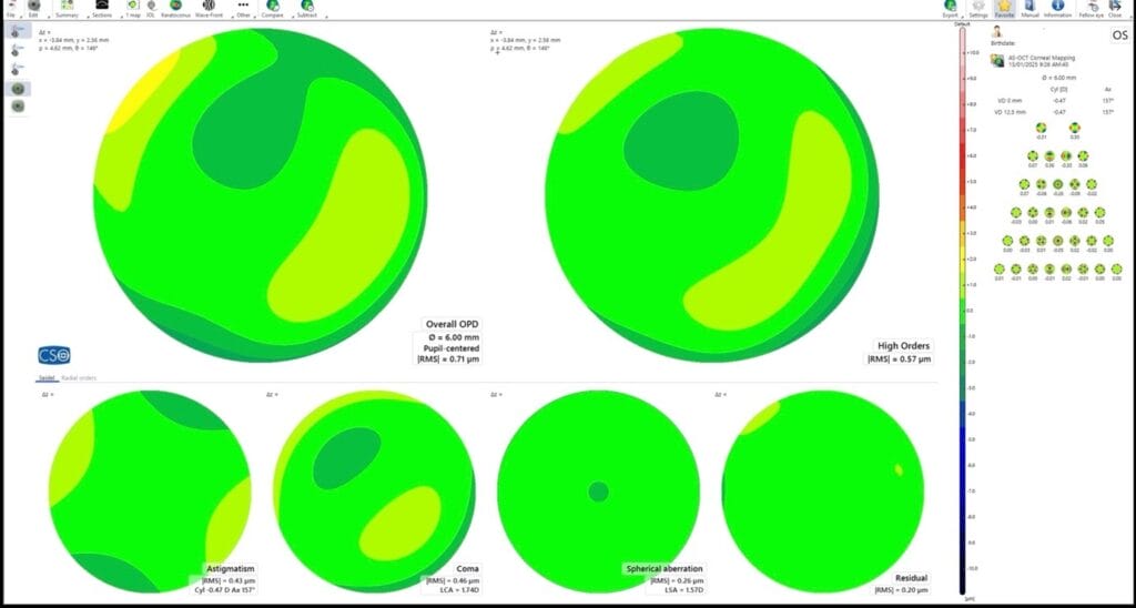 Figure 2. An example of an MS-39 corneal aberration profile. 