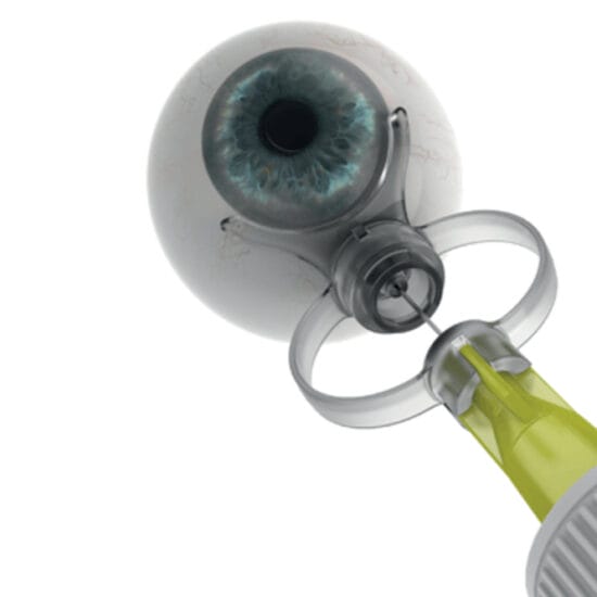 SP.Eye Intravitreal Device