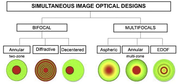 Figure 3. Simultaneous image optical designs of contact lenses. The colours indicate different viewing distances, and various configurations exist.