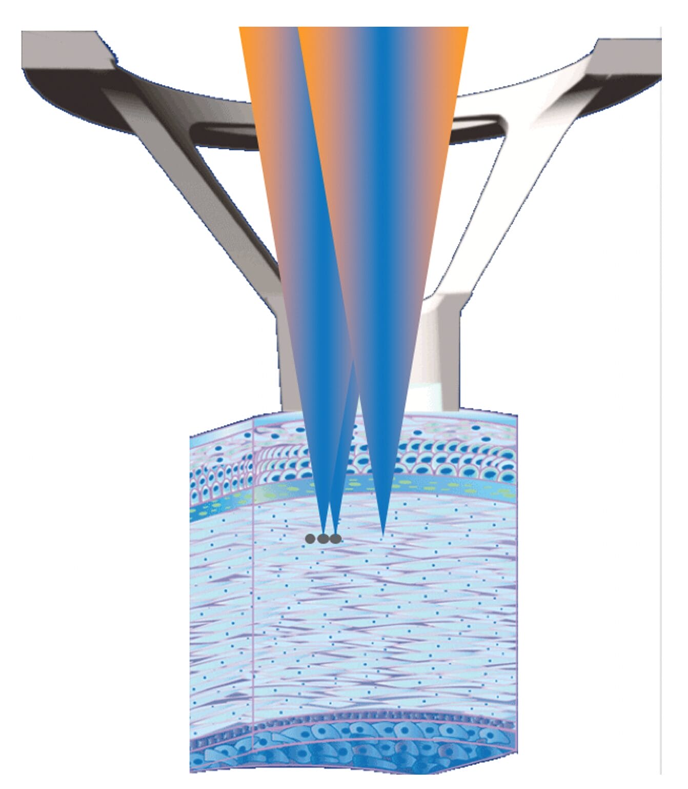 Figure 3. Lens pulses creating cleavage plane.