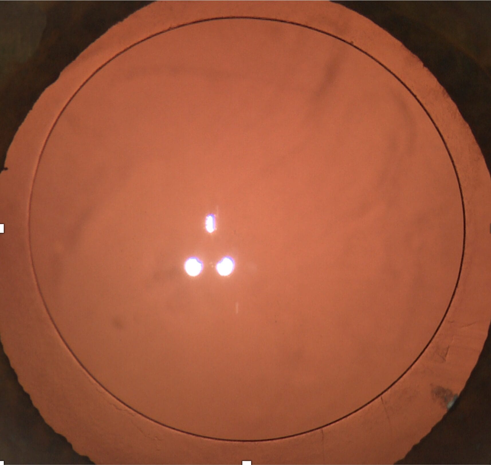 Figure 4a. Laser-generated capsulotomy.