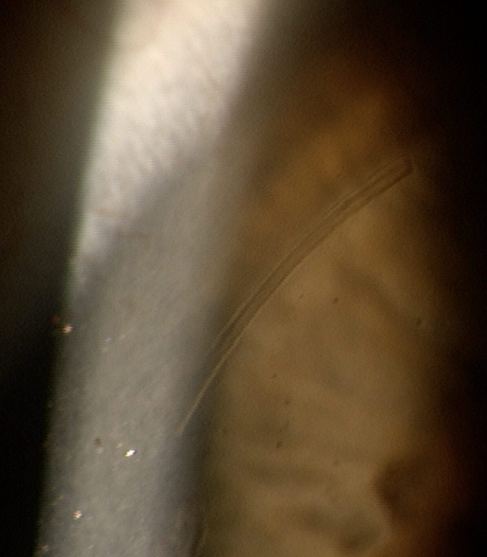 Figure 6. FLACS generated arcuate incisions.