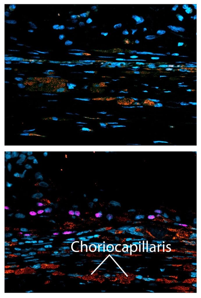 Top image shows the scaffold-only, which served as a control. Bottom image shows how the scaffold with RPE regenerated the choriocapillaris (labelled red), the part of the eye that supplies the retina with oxygen and nutrients. Kapil Bharti, PhD.