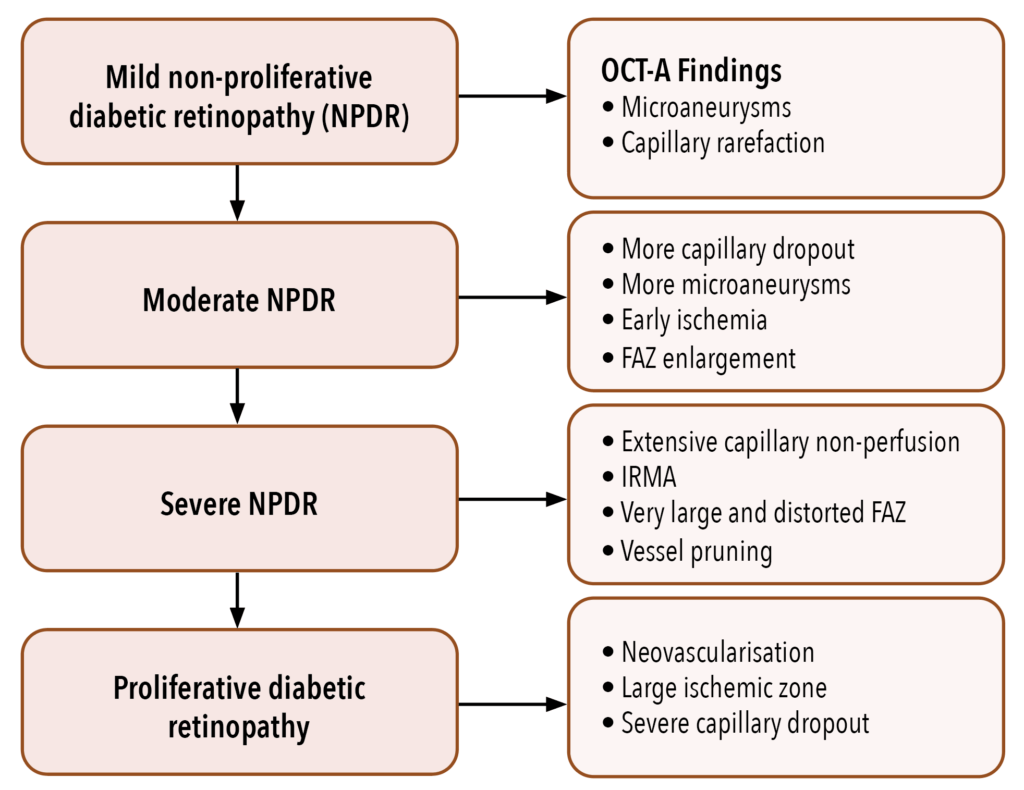 Table 2. OCT-A findings in the various stages of diabetic retinopathy.