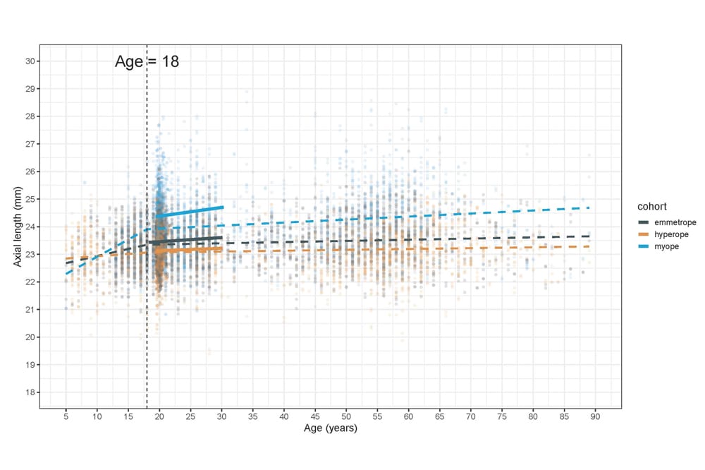 Figure 1 . Cross-sectional axial length measurements from eight studies with best fit for myopic, emmetropic, and hyperopic eyes (dashed lines). Solid lines represent the two time points at age 20 years and age 28 years of the Raine Study.
