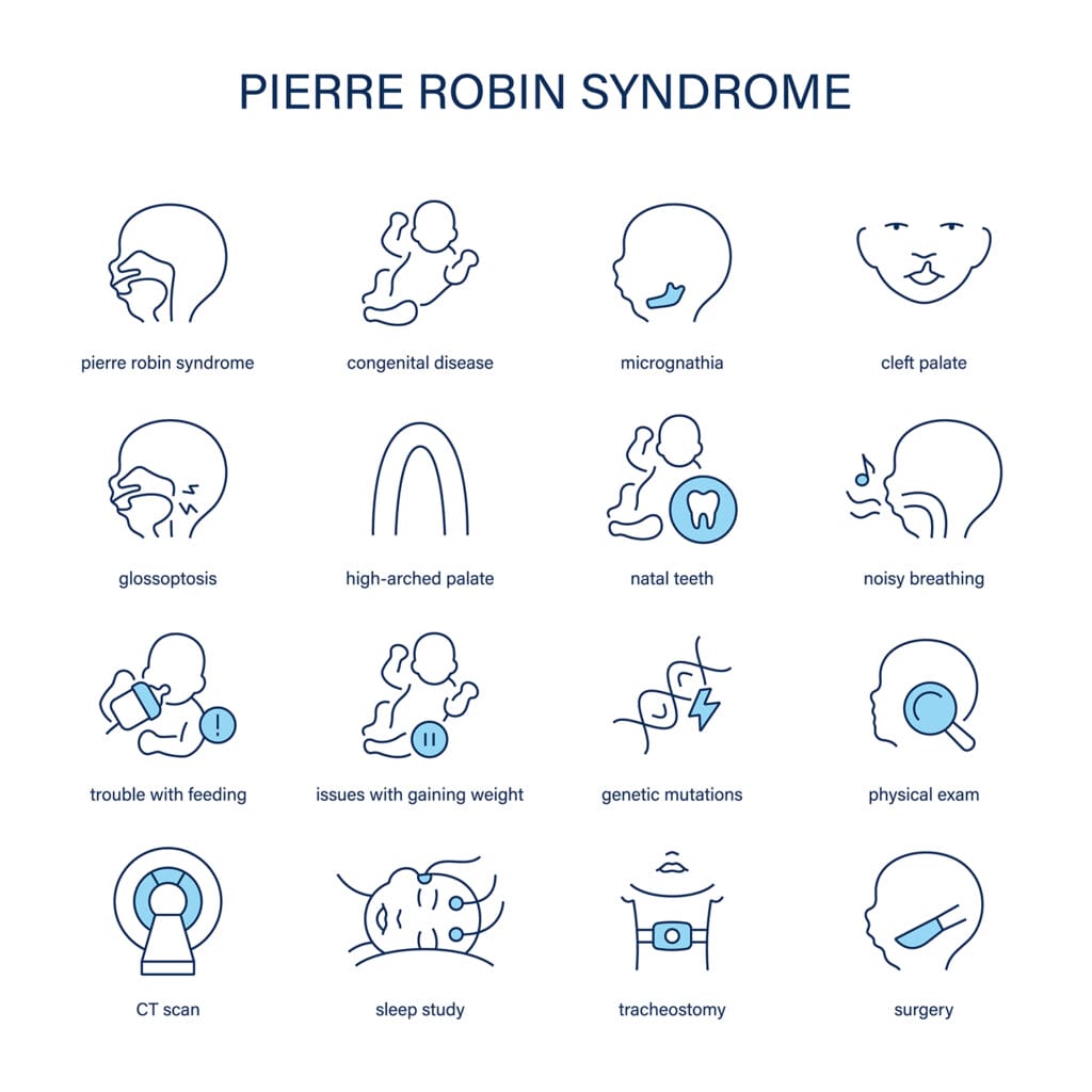 Figure 2. Signs of, and medical interventions for, Pierre-Robin syndrome.