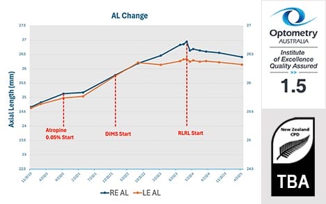 Red light for myopia graph - 1.5 hours CPD