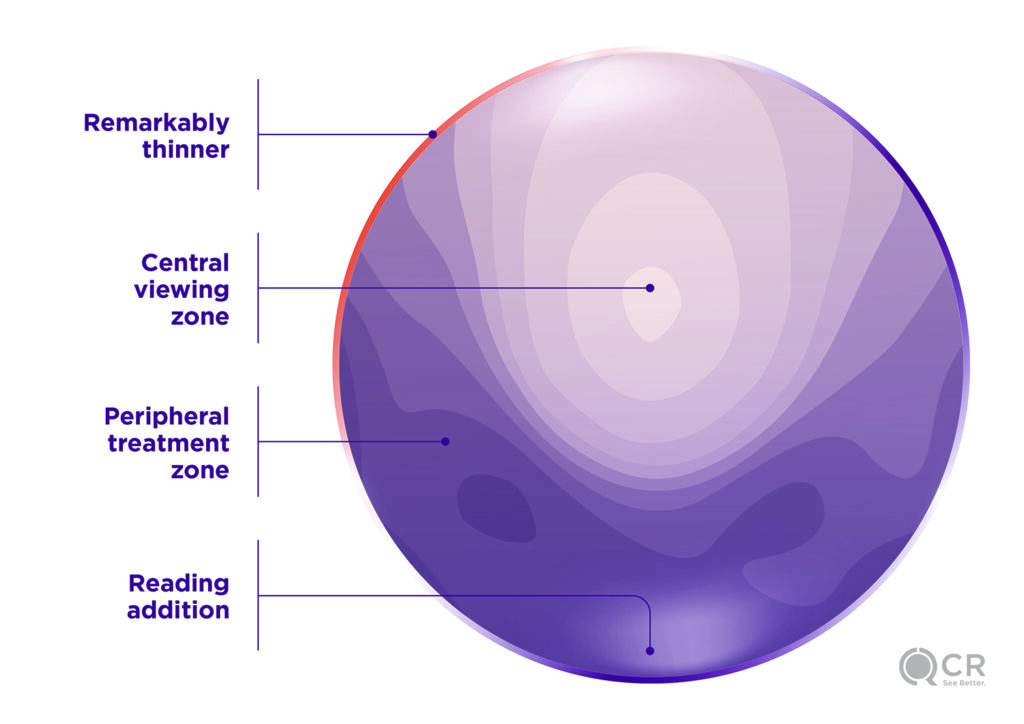 MyoMe lenses for myopia management