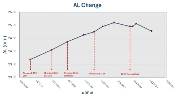 Figure 3. Axial length changes for patient Jing Kwok* from mid-2020 to late 2024.