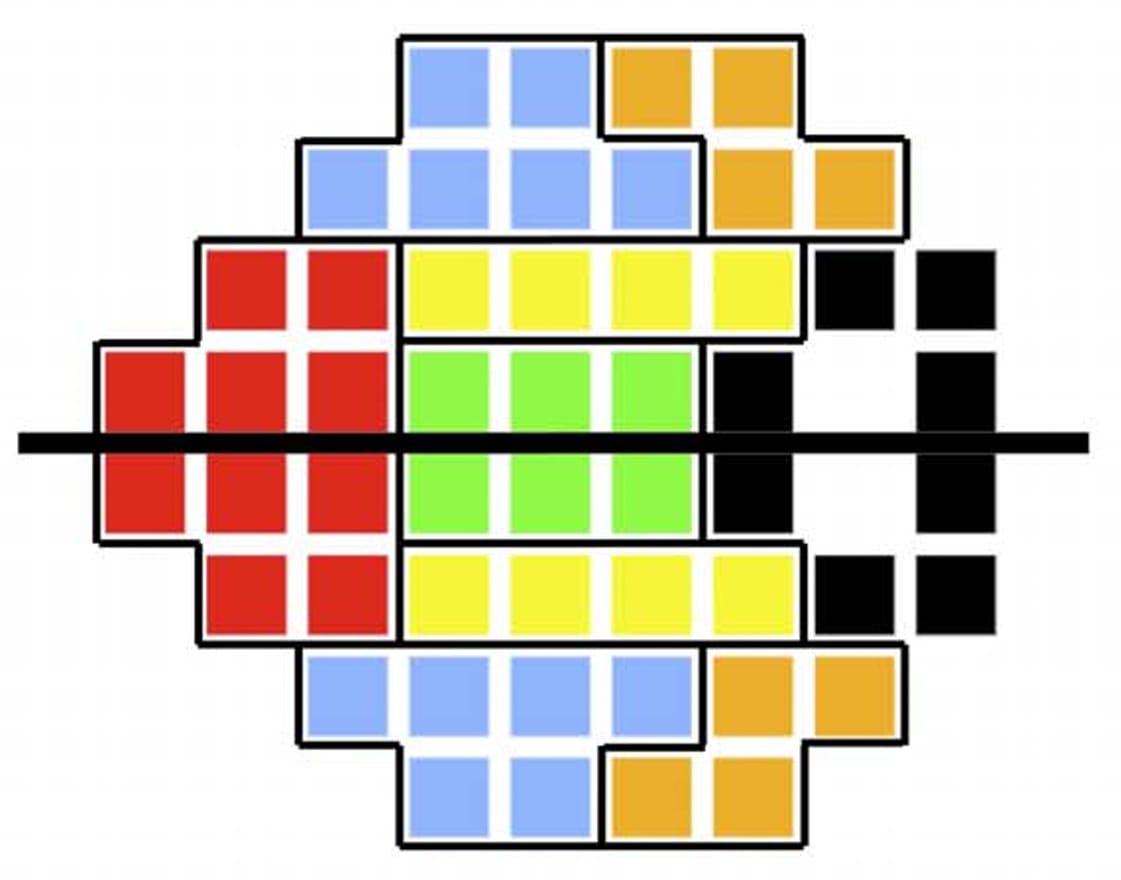 Visual Field Testing: A Guide to Interpreting Reports - mivision